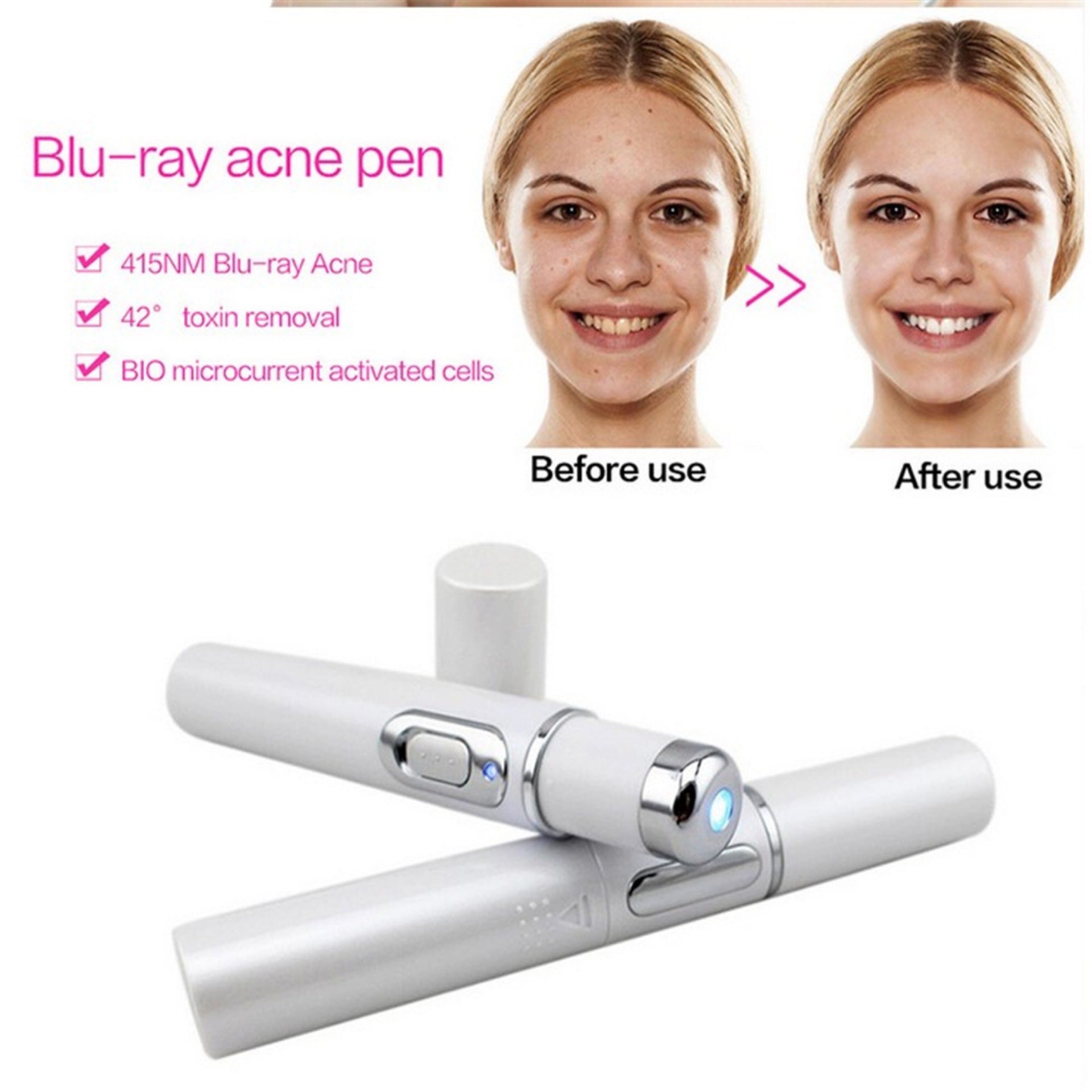 Blue Light Therapy Acne Laser Pen Soft Scar Wrinkle Removal Treatment Device Skin Care Beauty Equipment - Heritage cosmetics and beauty care