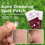 Skin Care Tools Acne Dressing Spot Patch Blemish Treatment Invisible Acne Stickers Pimple Remover Set Face Cream - Heritage cosmetics and beauty care