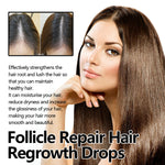 Thick Hair Hair Anti-fall Strong Hair Fixing Serums - Heritage cosmetics and beauty care