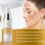 Facial And Body Black Spot Remover - Heritage cosmetics and beauty care