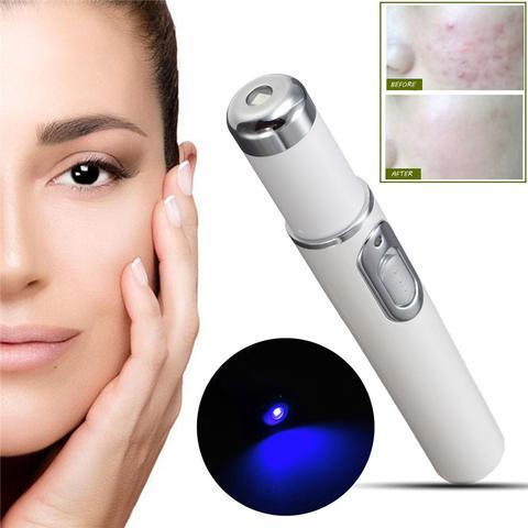 Blue Light Therapy Acne Laser Pen Soft Scar Wrinkle Removal Treatment Device Skin Care Beauty Equipment - Heritage cosmetics and beauty care