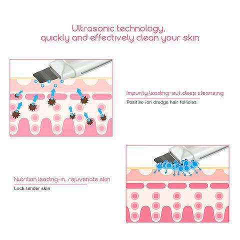 Ultrasonic Skin Scrubber Face Cleanser Blackhead Acne Removal Facial Spa Vibration Massager Ultrasound Peeling Clean Machine 394 - Heritage cosmetics and beauty care