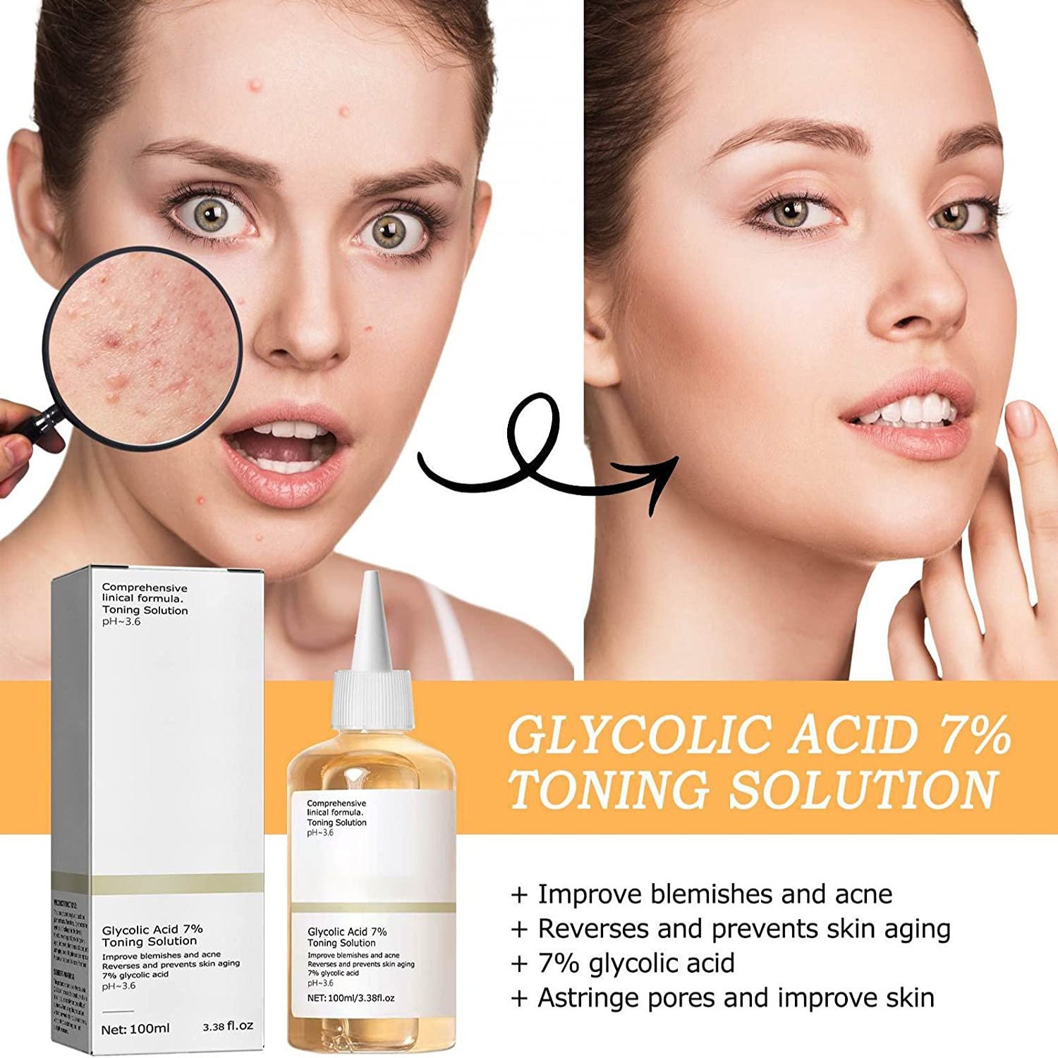 Glycolic Acid Lotion Acne Removal Smallpox Diluting - Heritage cosmetics and beauty care