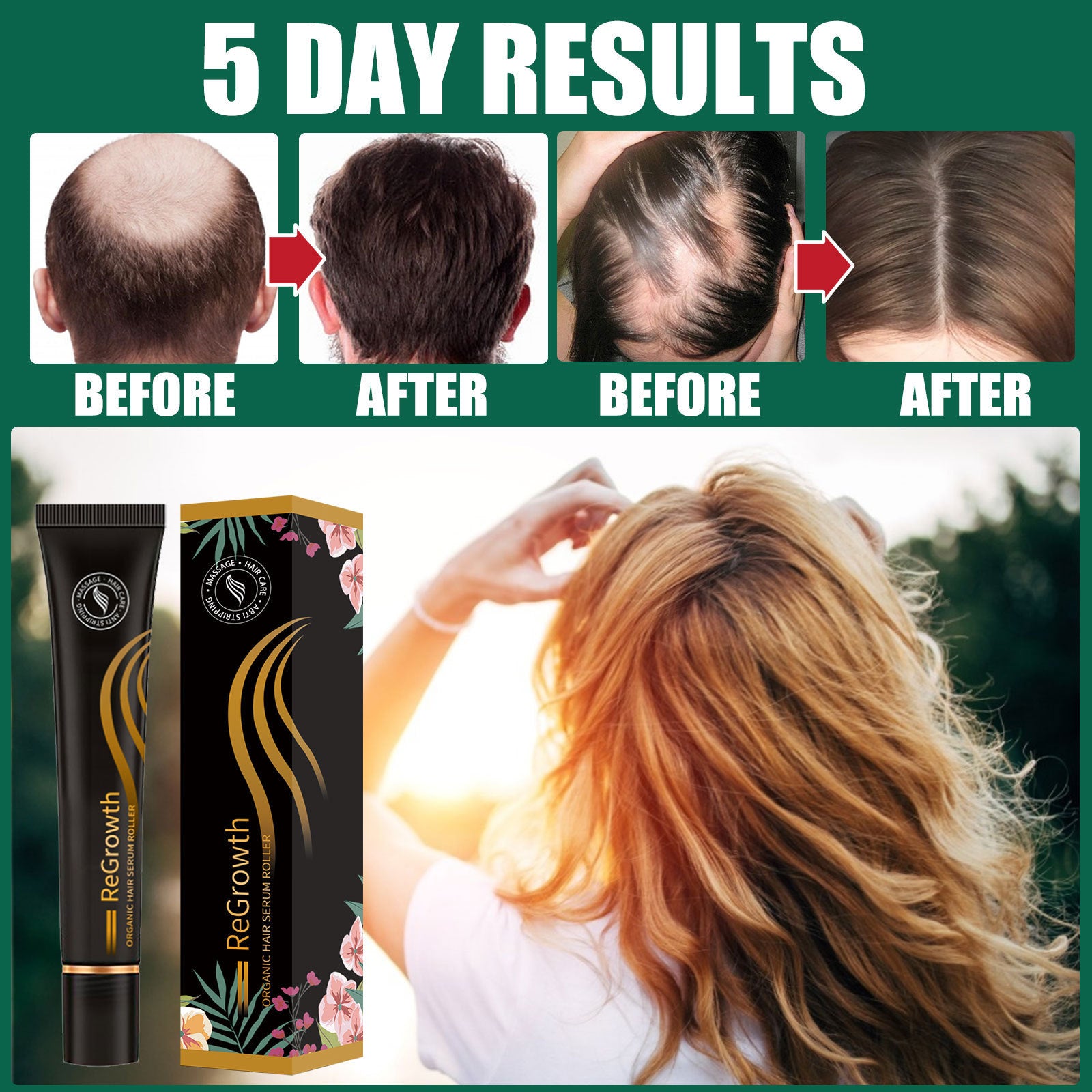 Regrowth Organic Hair Serum Roller Set Hair Care Anti Stripping Liquid Suitable For All Types Of Hair Loss Scalp Nourishing - Heritage cosmetics and beauty care